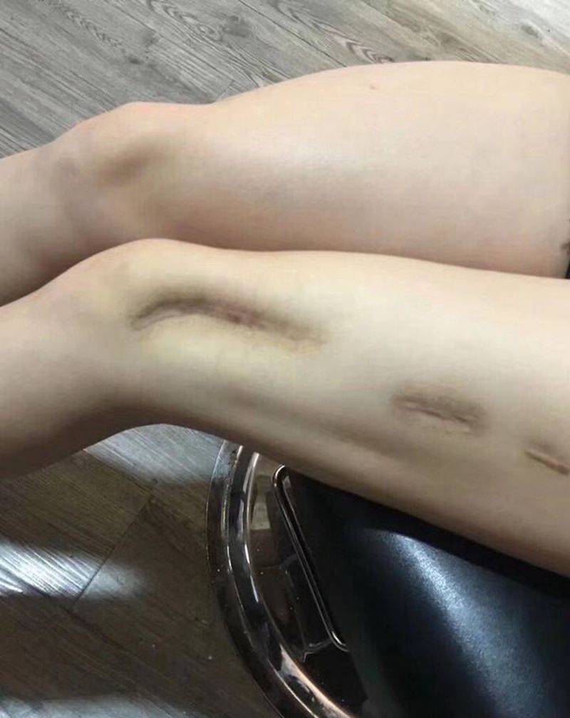 盖疤纹身图片_腿部纹身图案