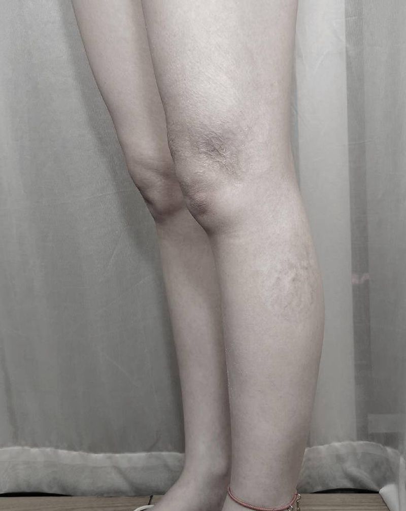 新中式水墨刺青疤痕遮盖纹身图片_腿部水墨纹身图案