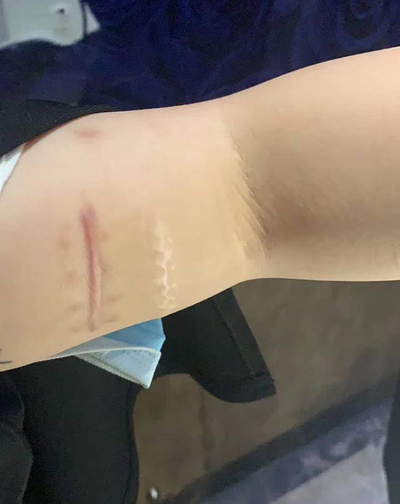 伤疤覆盖纹身图片_手部纹身图案