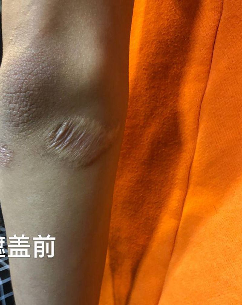 疤痕遮盖纹身图片_手臂欧美写实点刺猫暗黑纹身图案