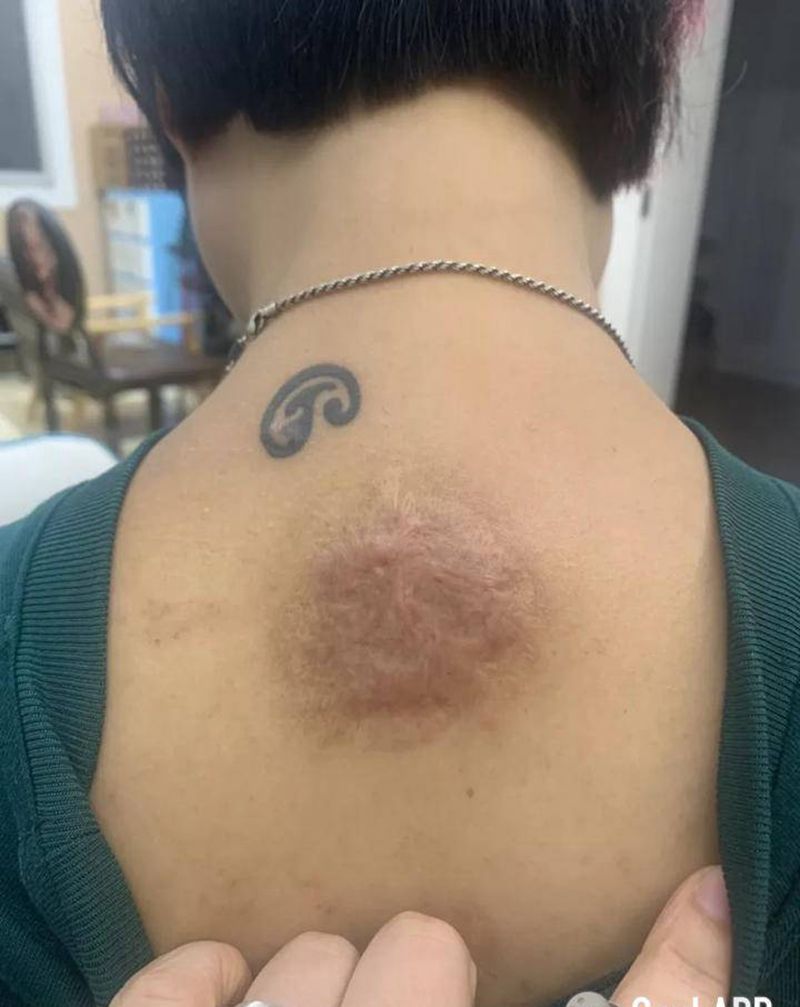 疤痕遮盖纹身图片_背部几何点刺纹身图案