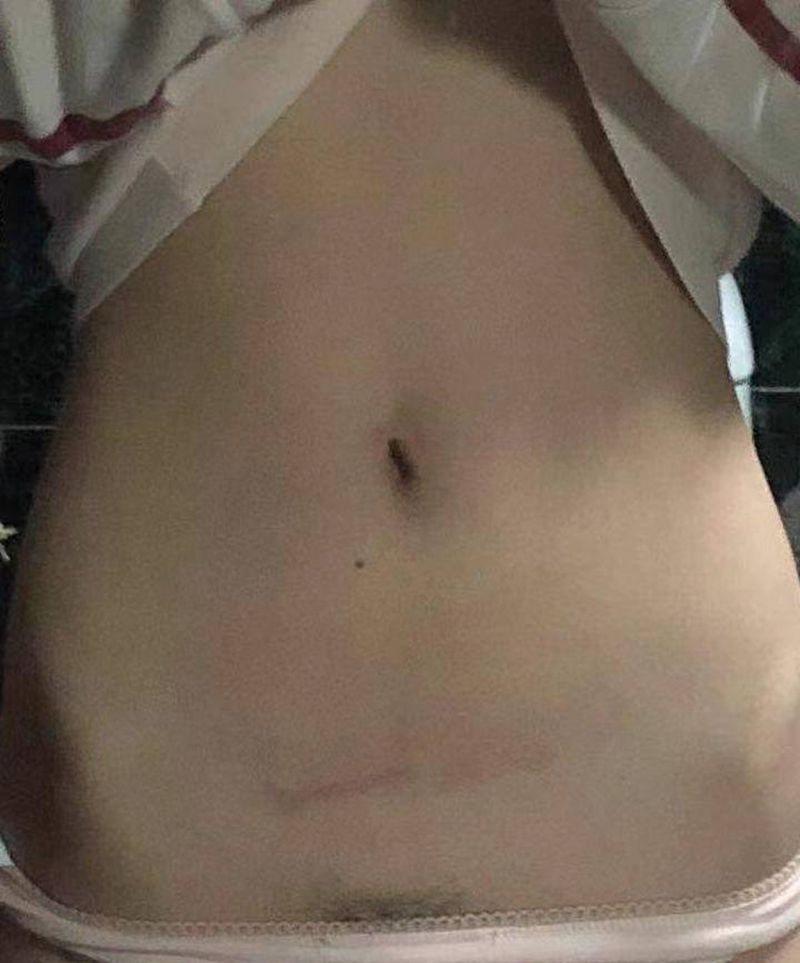 覆盖疤痕纹身图片_腹部纹身图案