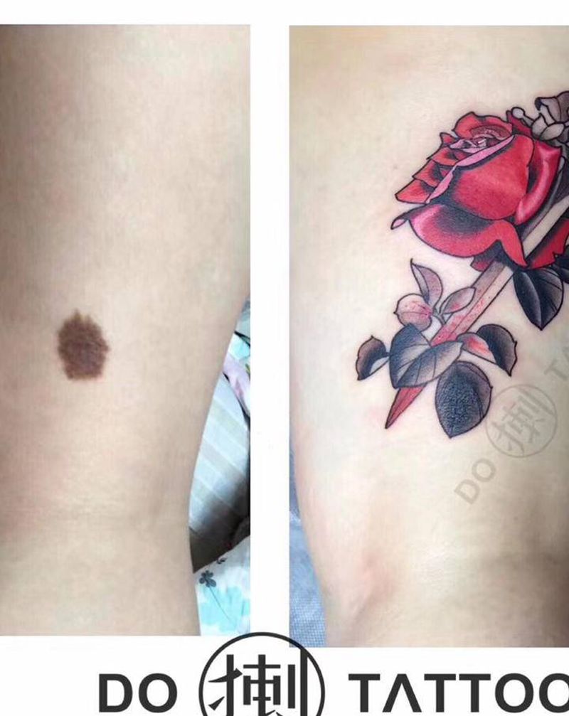 痣遮盖纹身图片_腿部手臂New School纹身图案