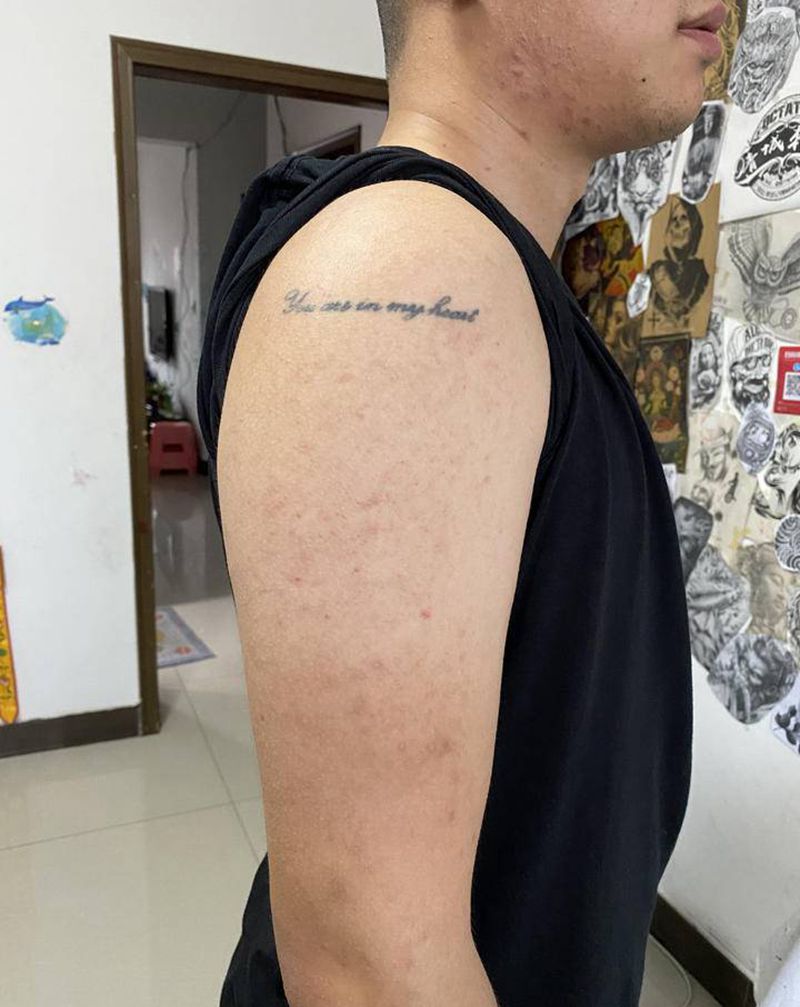 遮盖失败纹身鲤鱼纹身纹身图片_手臂老传统纹身图案