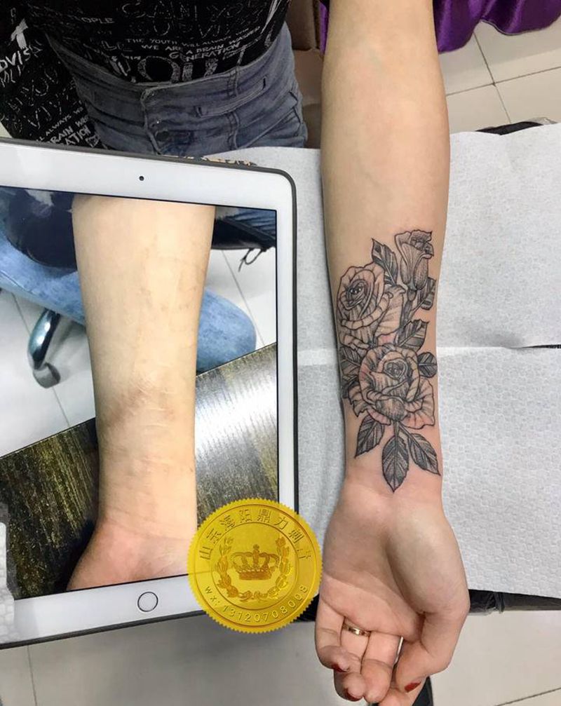 DL 疤痕遮盖纹身图片_手臂点刺纹身图案