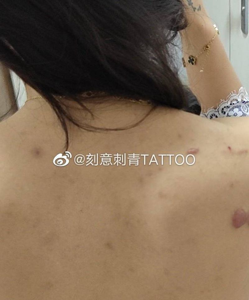 疤痕结合纹身图片_背部水墨梅花疤痕纹身图案