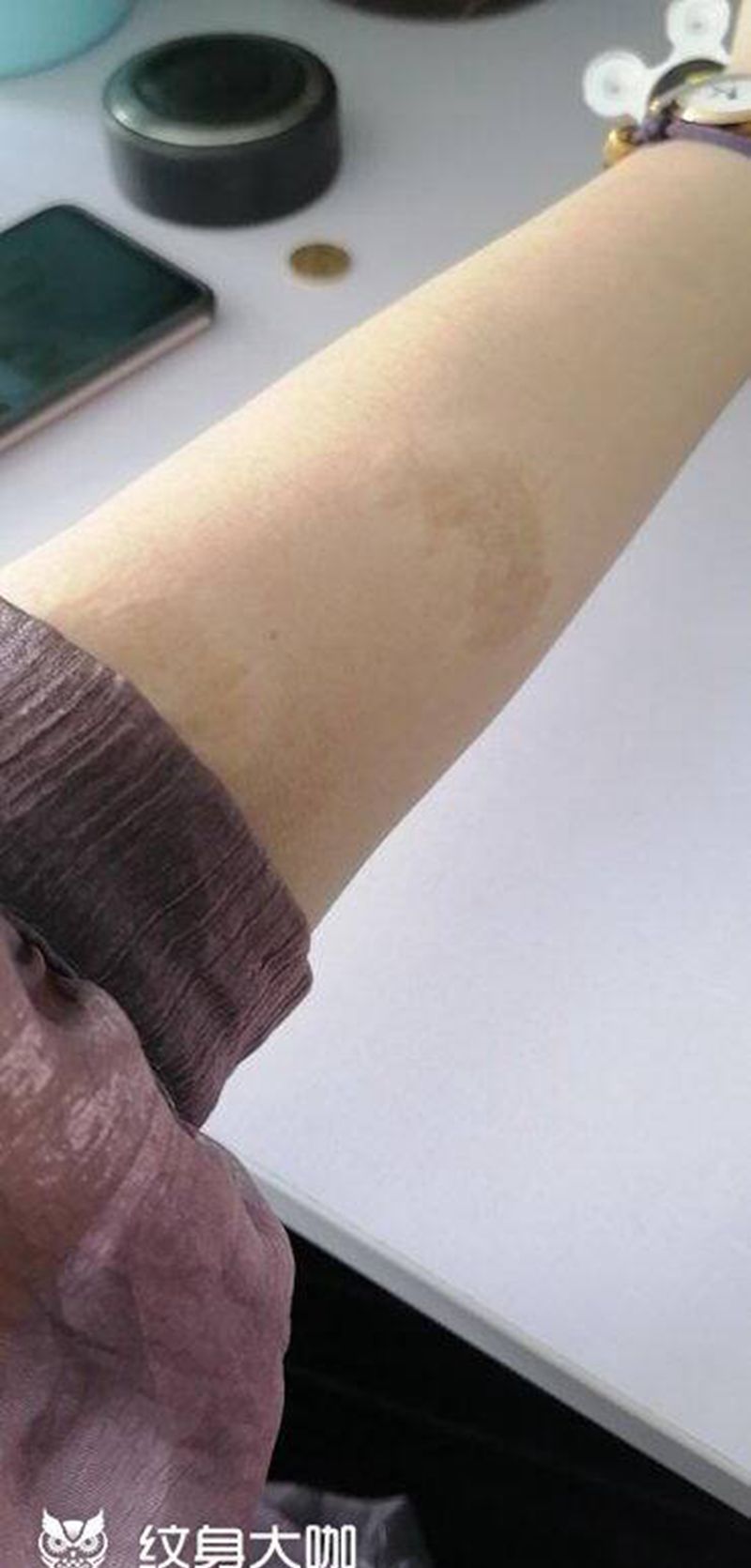 疤痕遮盖纹身图片_手臂欧美写实纹身图案