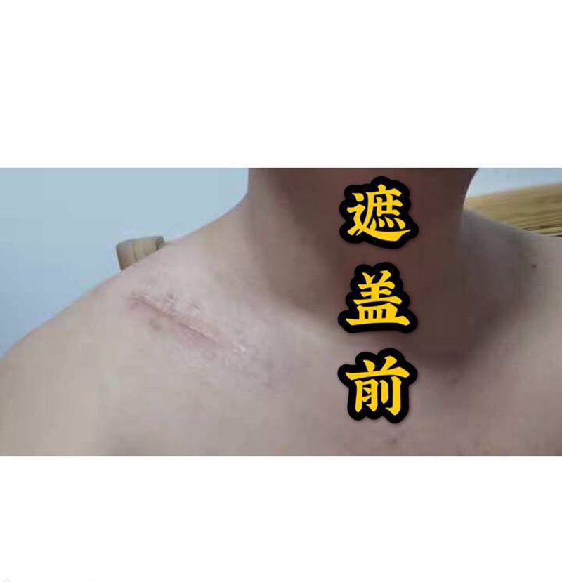 疤痕遮盖纹身图片_肩部纹身图案