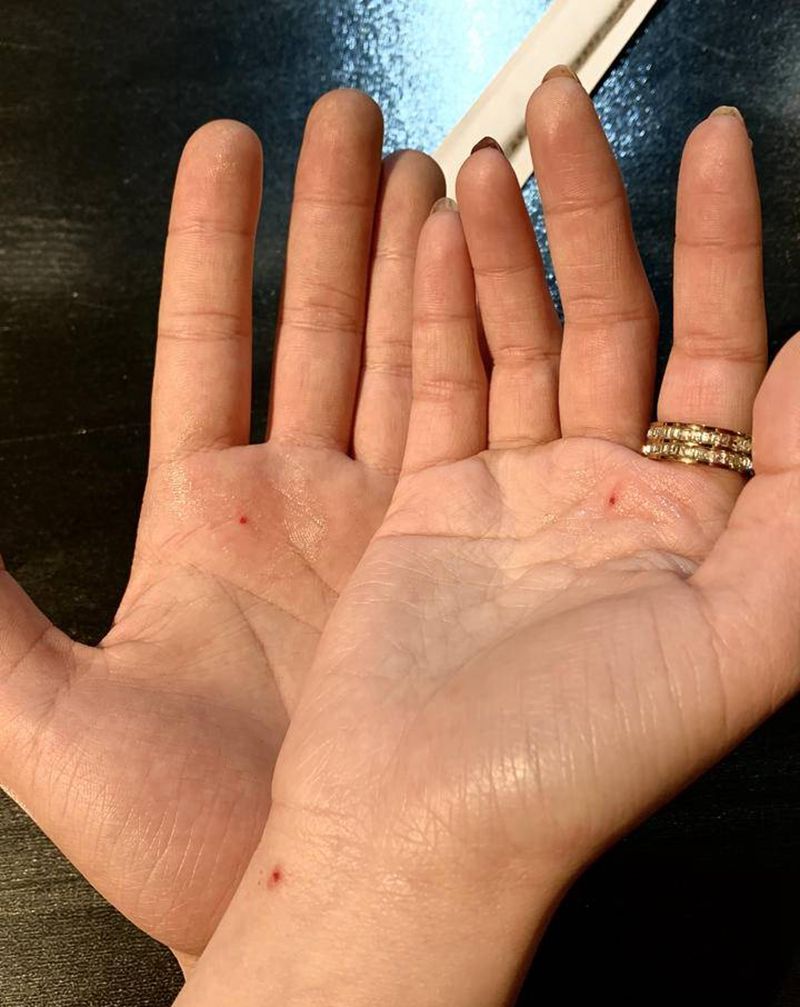 朱砂痣纹身图片_点刺纹身图案