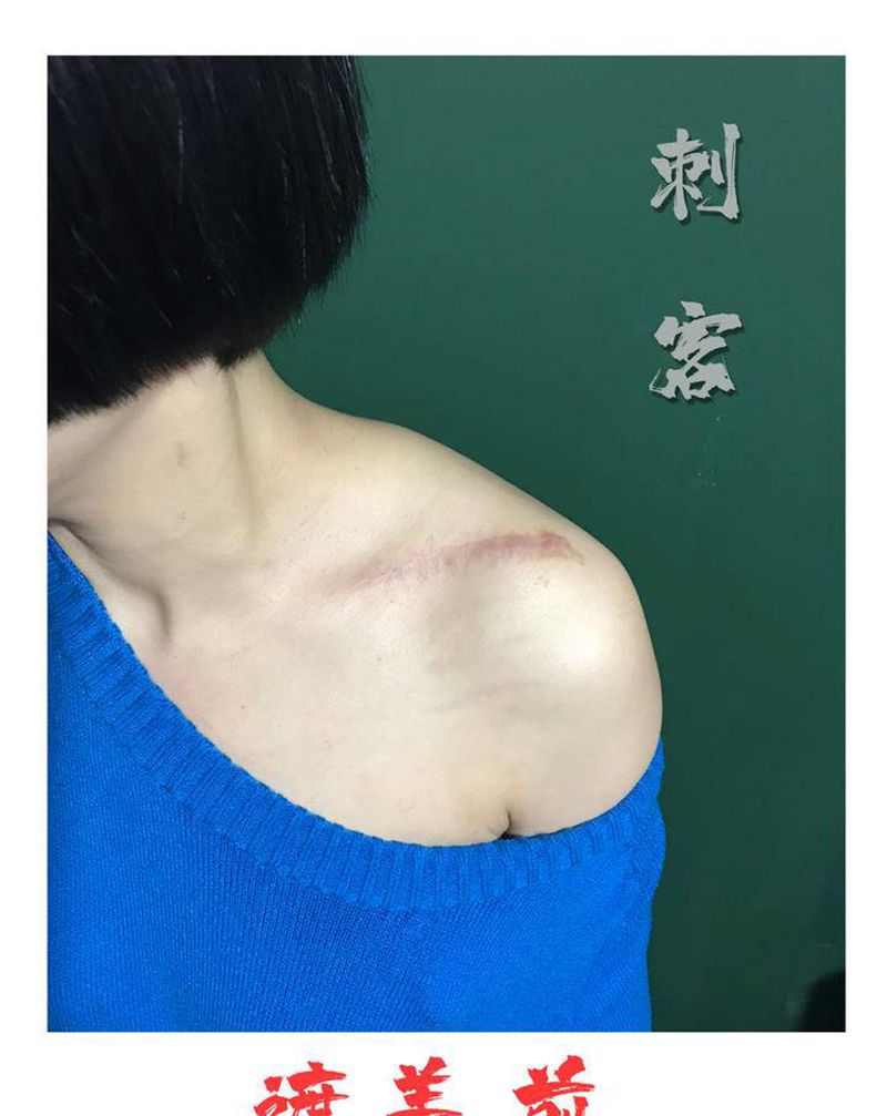 疤痕遮盖纹身图片_肩部纹身图案