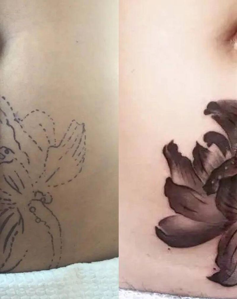 遮疤（莲花）纹身图片_腹部水墨纹身图案