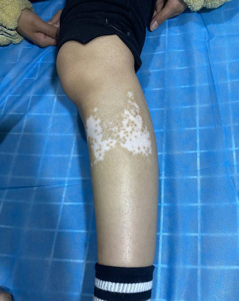 遮盖白癜风纹身图片_腿部点刺纹身图案