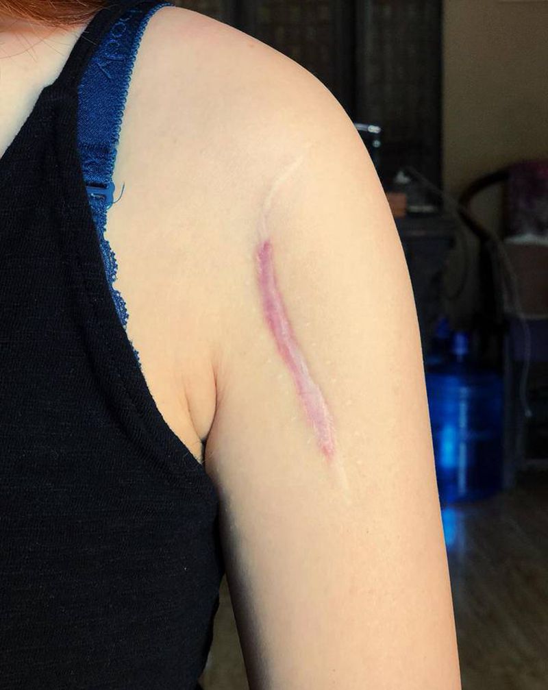 覆盖疤痕～纹身图片_老传统纹身图案