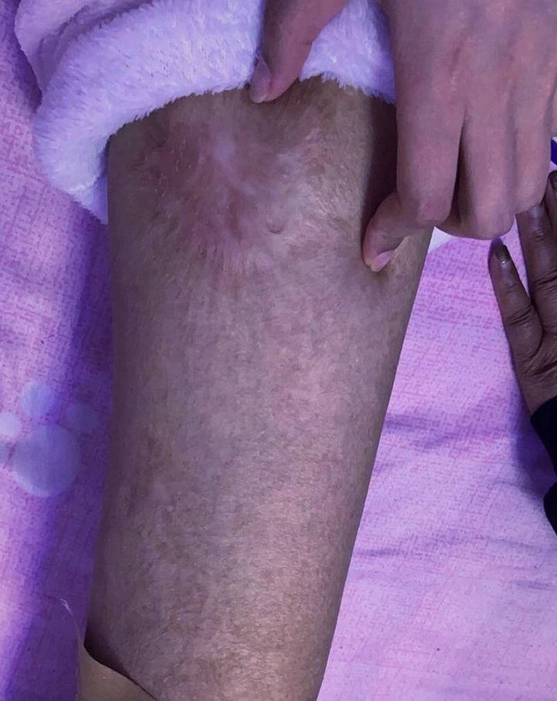 覆盖·疤痕纹身图片_老传统纹身图案