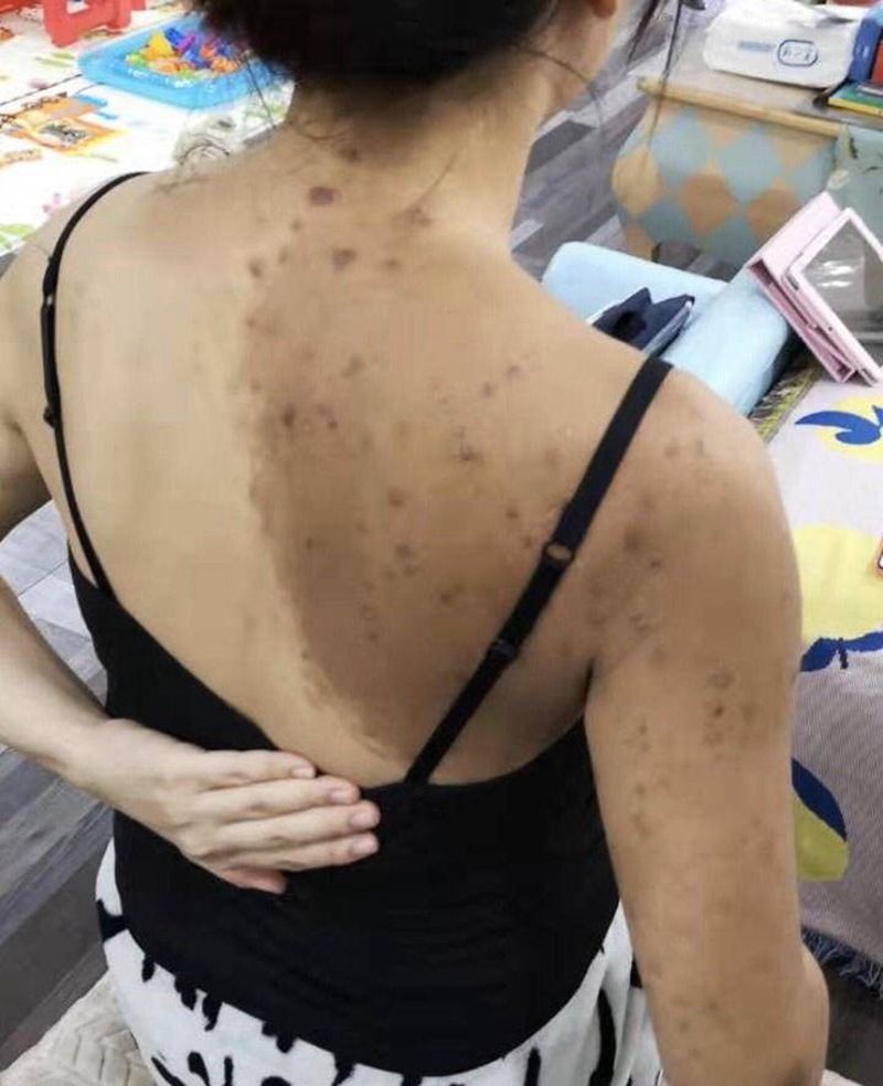 胎记遮盖纹身图片_背部手臂欧美写实新传统纹身图案