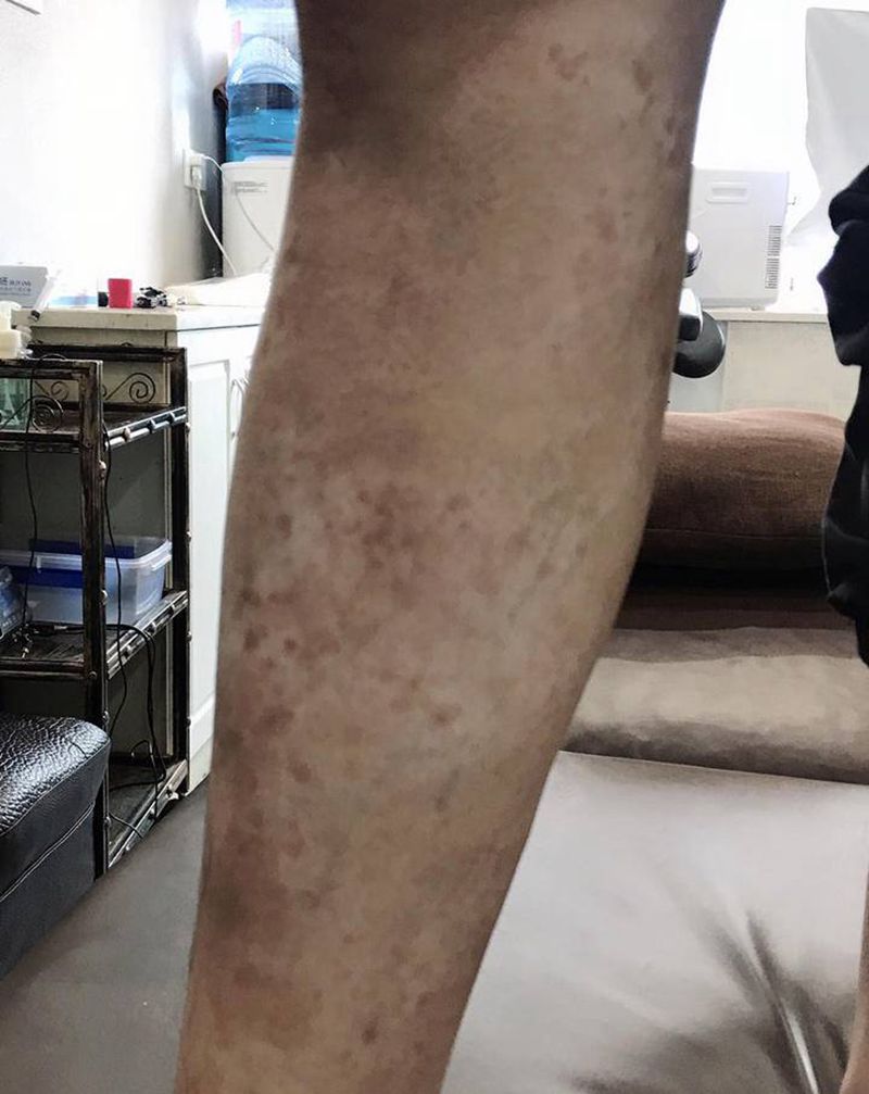 鹤 遮盖烫伤疤痕纹身图片_腿部脚部纹身图案