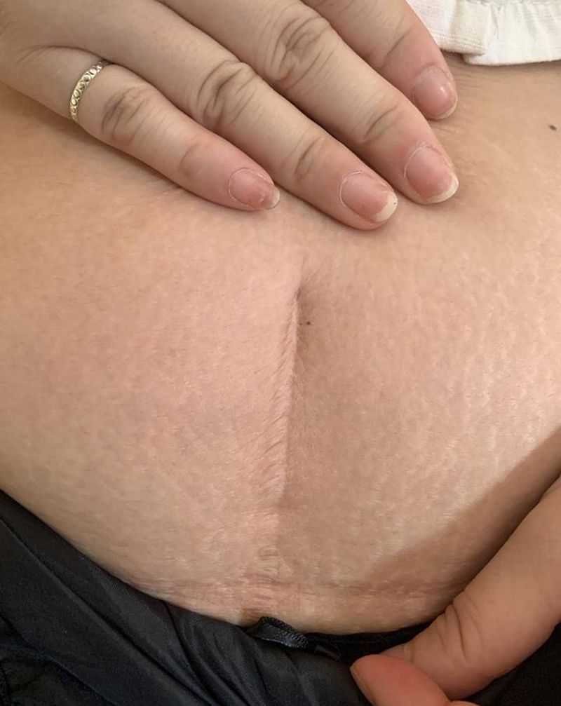 羽毛疤痕遮盖纹身图片_腹部纹身图案