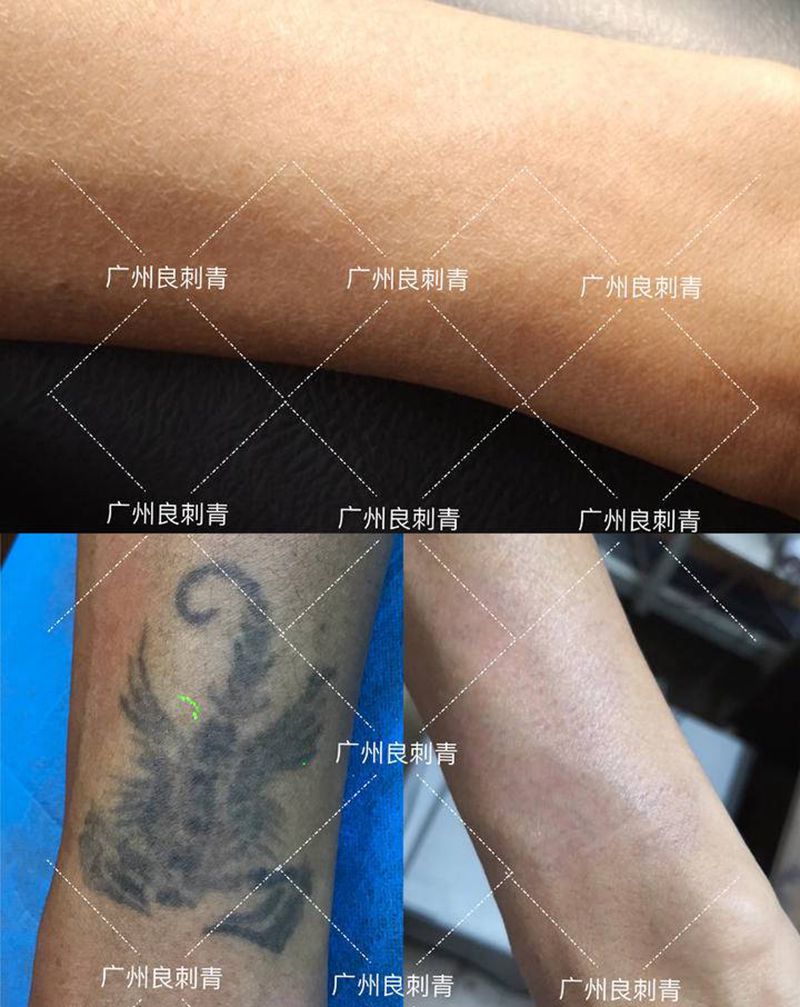 洗纹身两次效果纹身图片_洗纹身图案