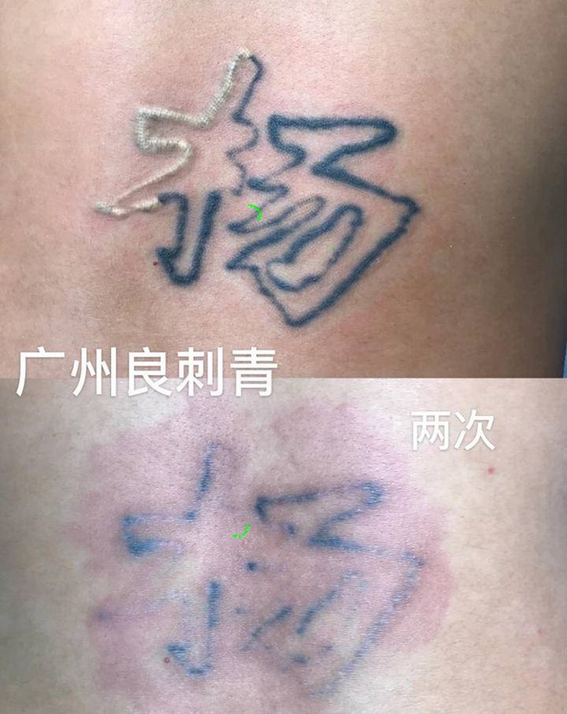 洗纹身两次效果纹身图片_洗纹身图案