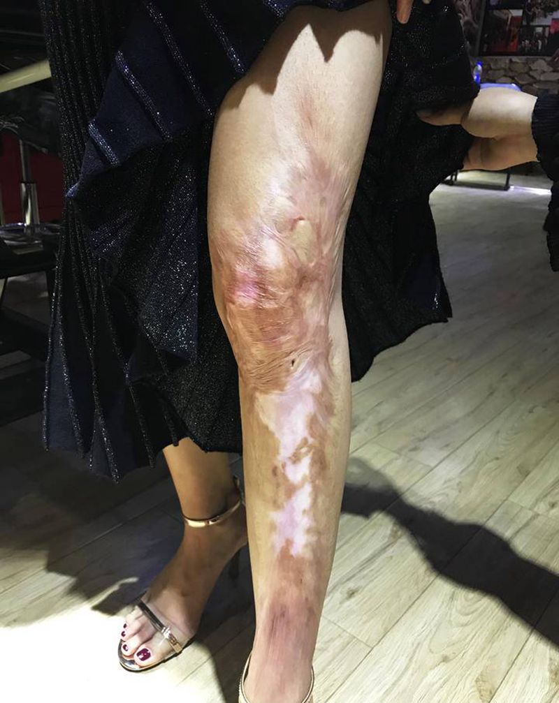 大型疤痕遮盖纹身图片_腿部欧美写实纹身图案