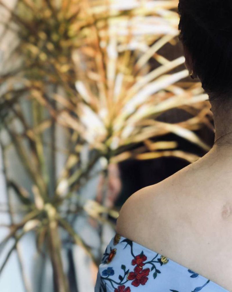 疤痕覆盖(一叶竹林)纹身图片_肩部水墨点刺纹身图案