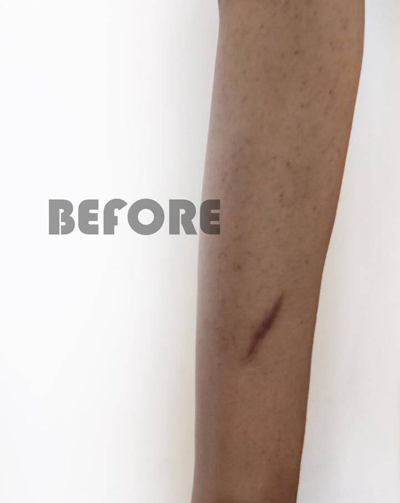 海贼王纹身图片_手臂手绘纹身图案