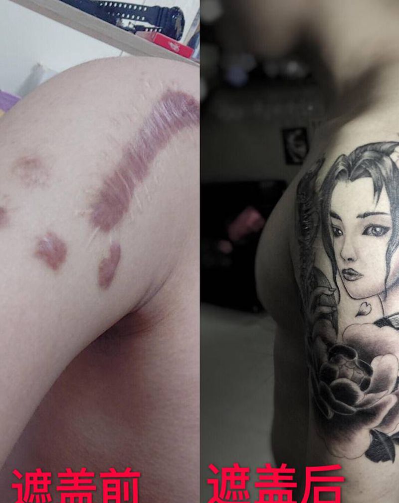 遮盖疤痕纹身图片_手臂纹身图案