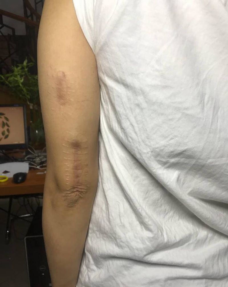 素花遮盖纹身图片_手臂素花纹身图案