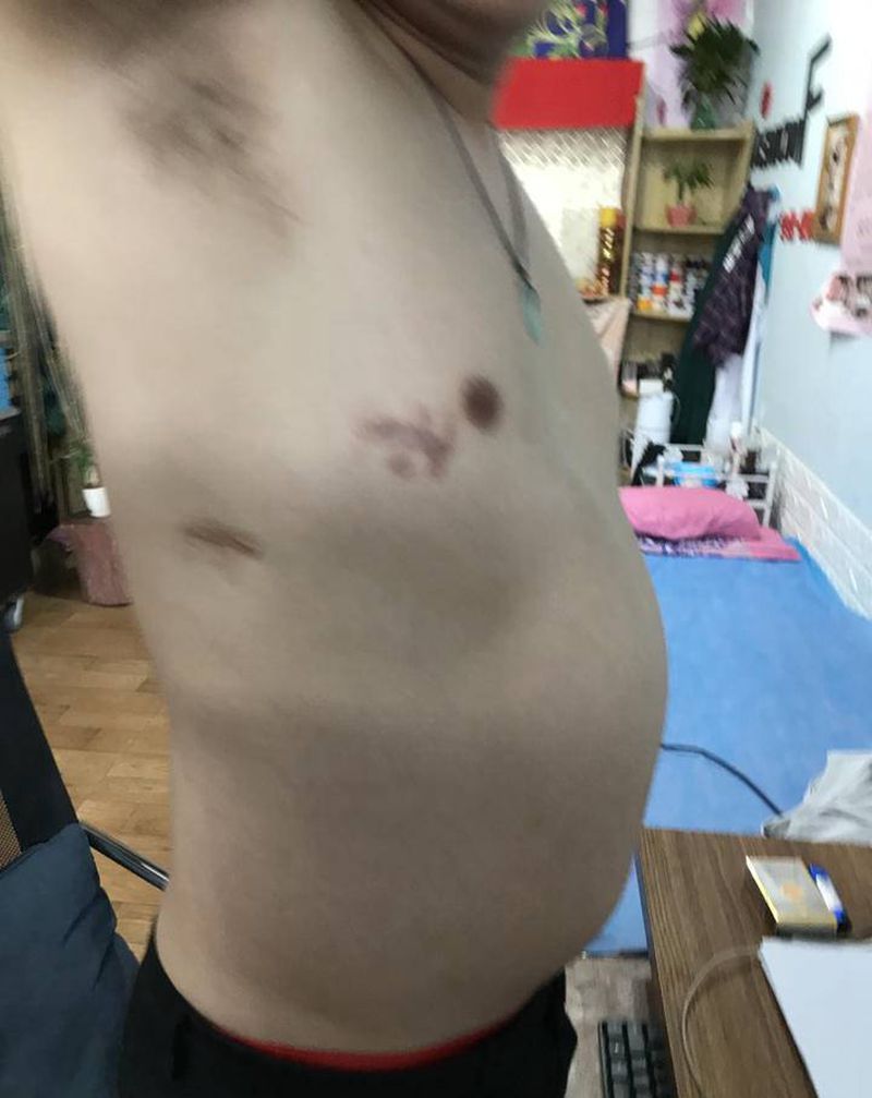 疤痕遮盖纹身图片_腰部纹身图案