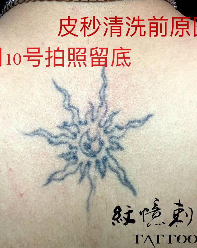 皮秒洗纹身，第一次恢复后对比纹身图片_颈部纹身图案
