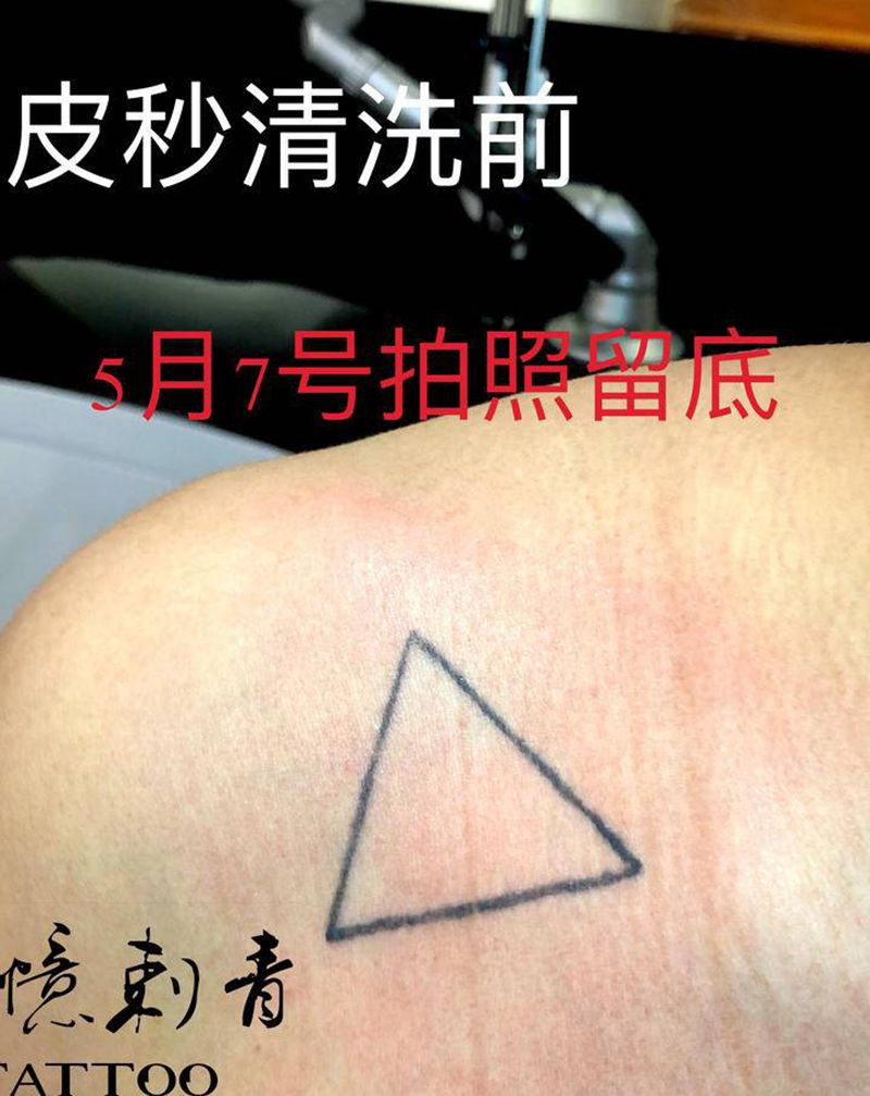 皮秒洗纹身，第一次恢复后对比纹身图片_肩部纹身图案