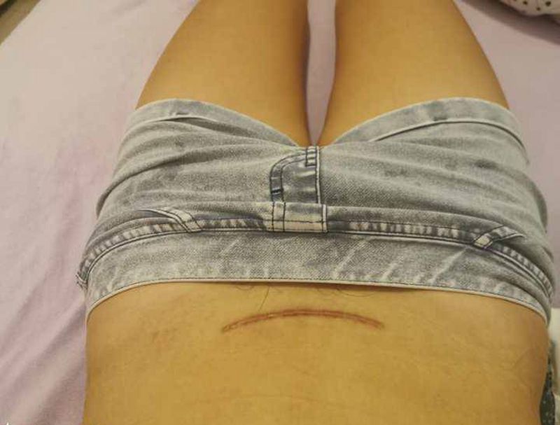 覆盖作品纹身图片_腹部点刺纹身图案