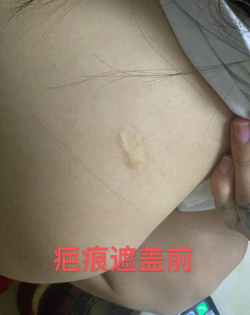 遮盖疤痕纹身图片_背部纹身图案