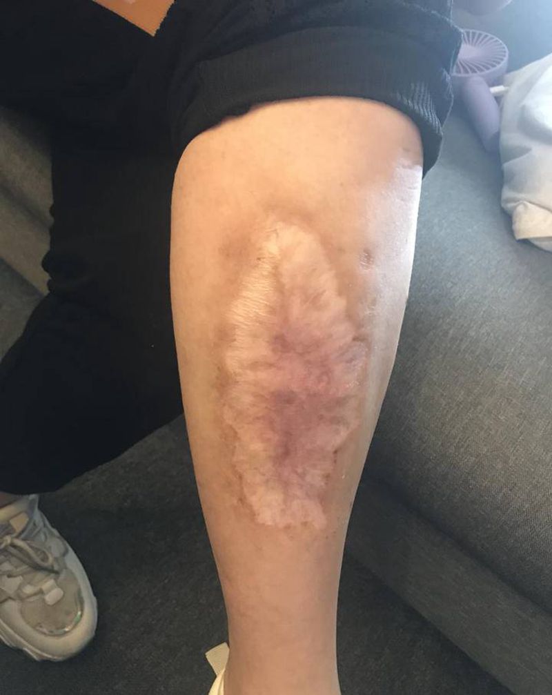 牡丹花遮盖纹身图片_腿部新传统牡丹花纹身图案