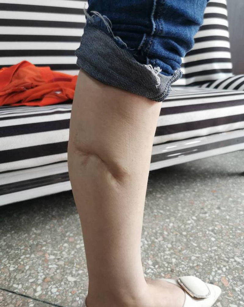 遮盖疤痕纹身图片_腿部纹身图案