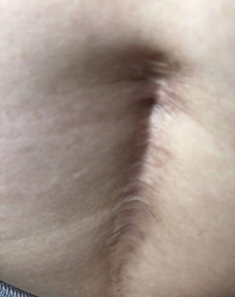 遮盖剖腹产纹身图片_腹部纹身图案