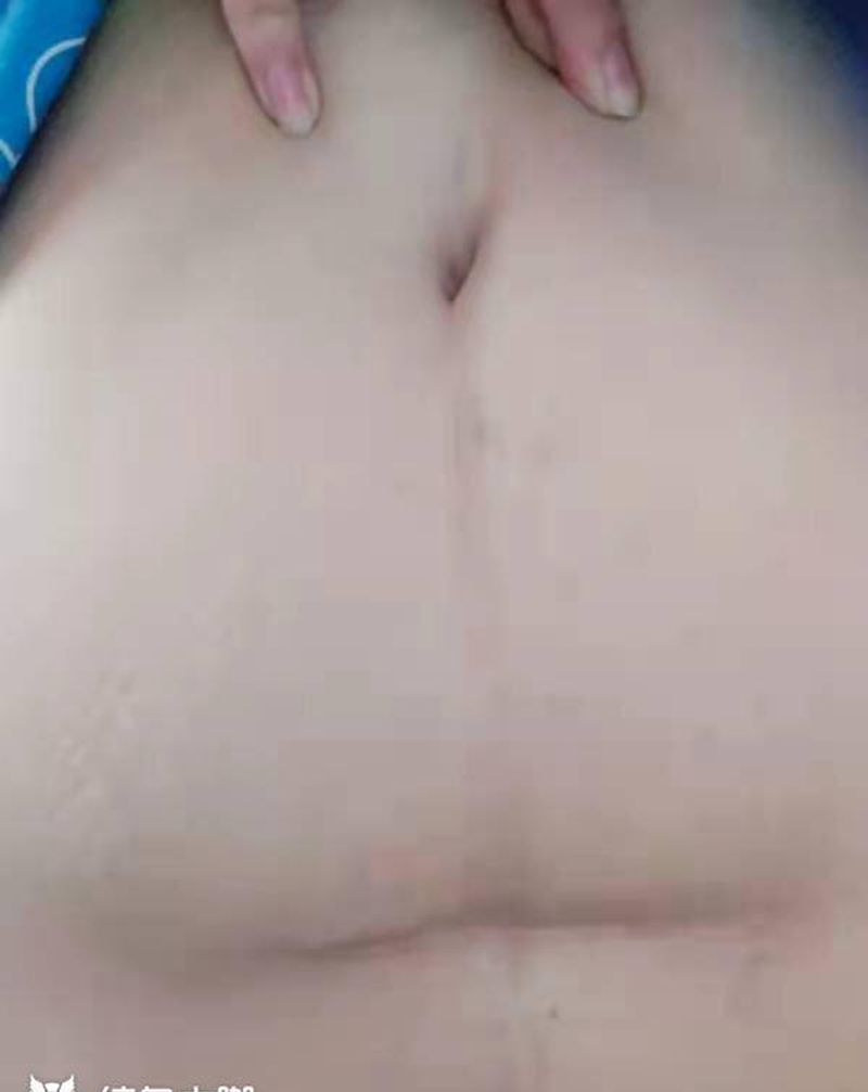 梵花遮盖剖腹产纹身图片_腹部纹身图案