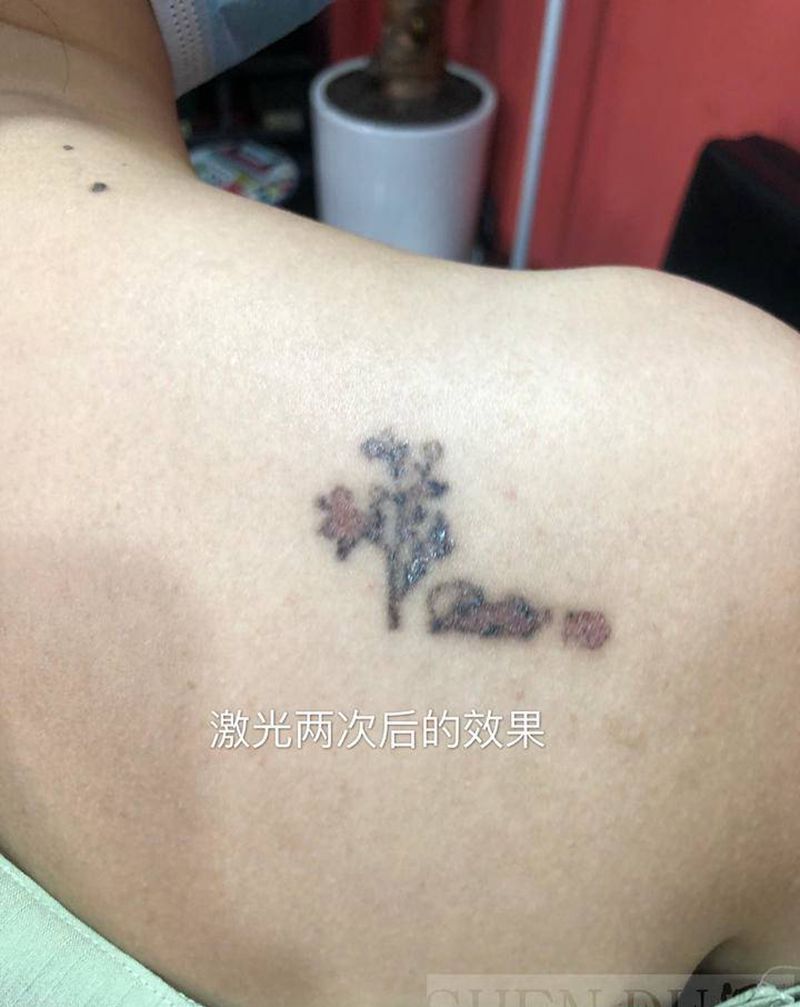 洗纹身的效果纹身图片_肩部纹身图案