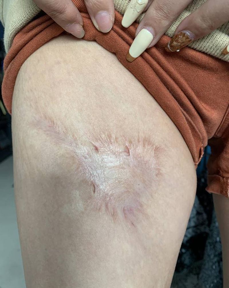 烫伤疤痕遮盖纹身图片_腿部欧美写实New School遮盖疤痕皮肤纹身图案