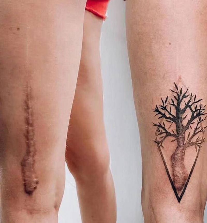 疤痕修饰纹身图片_手臂纹身图案