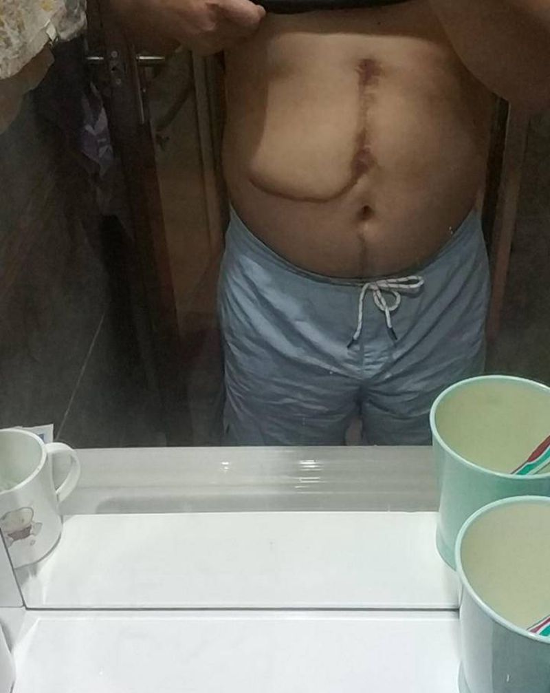 伤疤遮盖纹身图片_腹部水墨纹身图案