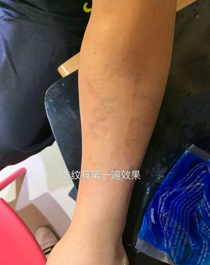 洗纹身纹身图片_手臂纹身图案