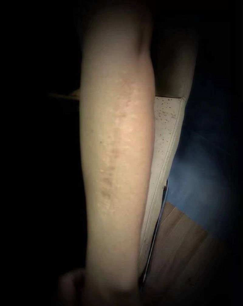 遮盖刀疤纹身图片_手臂纹身图案