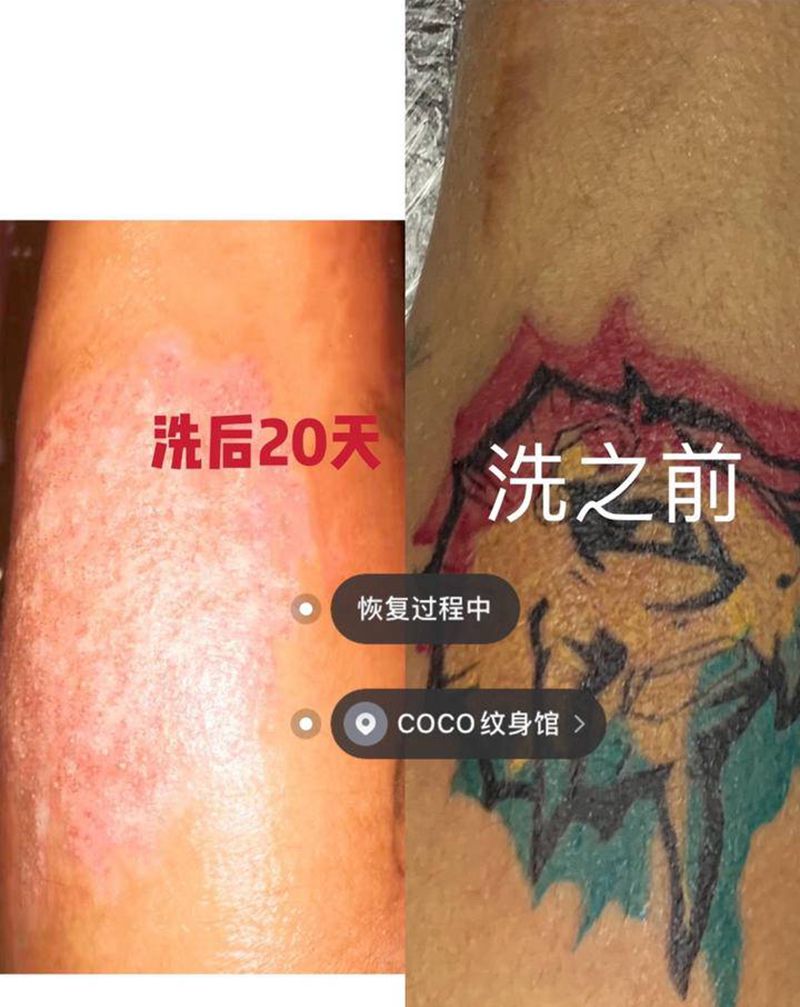 洗纹身，洗彩色纹身纹身图片_手臂纹身图案