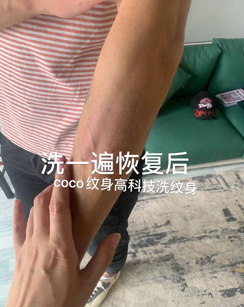 洗彩色纹身恢复后纹身图片_手臂纹身图案