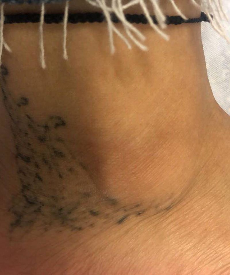 设计遮盖纹身图片_脚部纹身图案