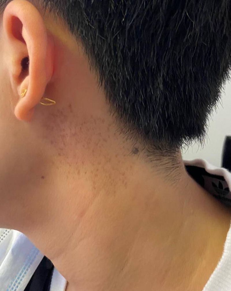 遮盖斑纹身图片_颈部纹身图案