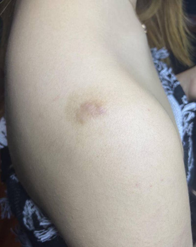 疤痕遮盖纹身图片_肩部Old School纹身图案