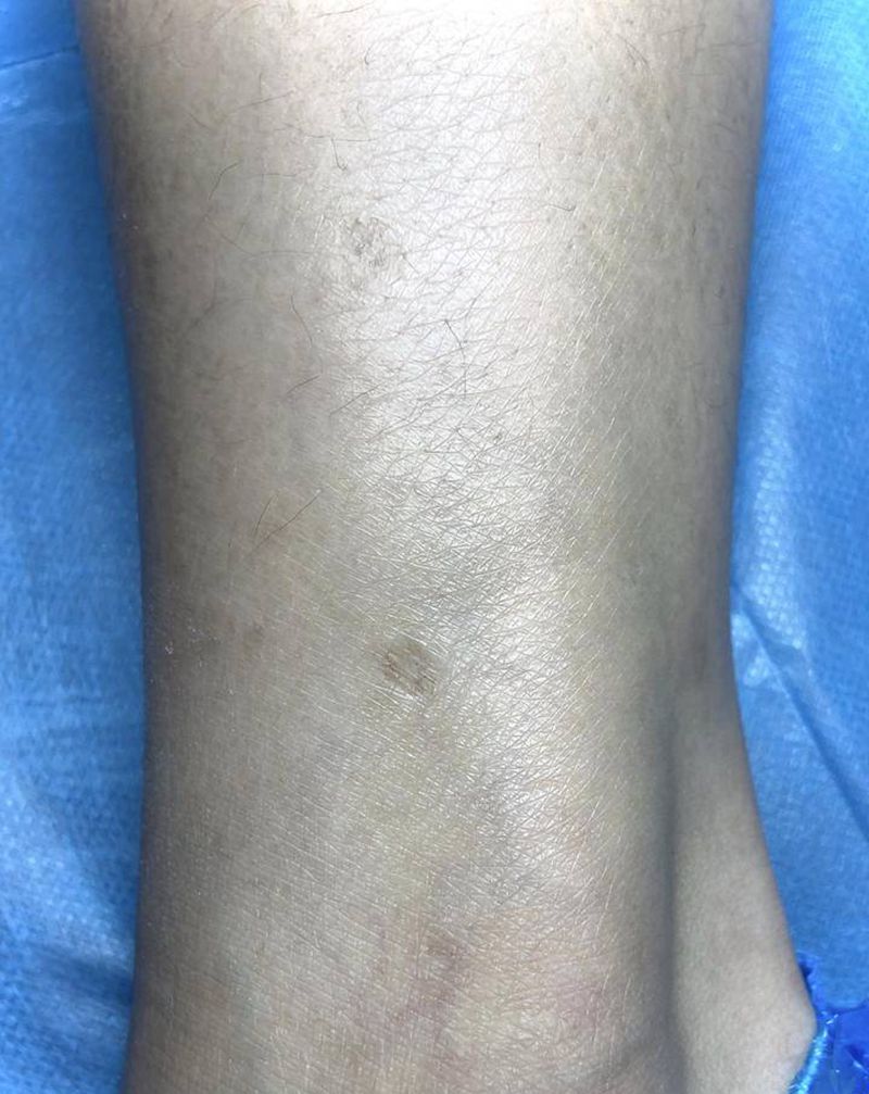 遮盖疤痕纹身图片_腿部纹身图案