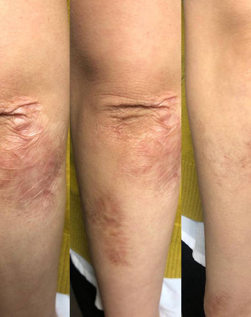 疤痕遮盖．纹身图片_手臂新传统纹身图案